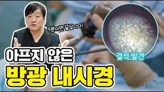 방광내시경 너무 아플 것 같은데… 꼭 해야 하나요?