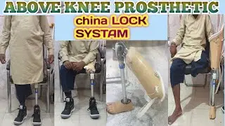 Artificial leg Above knee leg prosthetic madular  0322 4103286 #ottobock #prosthetics #leg #limb
