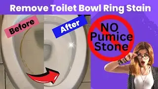 Remove Toilet Bowl Ring/Stain Safely