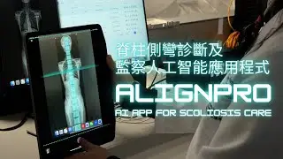 Medtech - AI App for Scoliosis Care | 【創科醫學】脊柱側彎診斷及監察人工智能應用程式  -  AlignPro