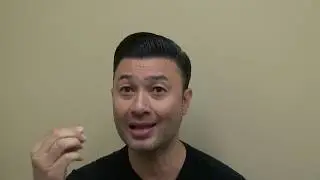 Hair Transplant 12 Month Follow Up Restoration Surgery Progress Dr. Diep http://www.mhtaclinic.com