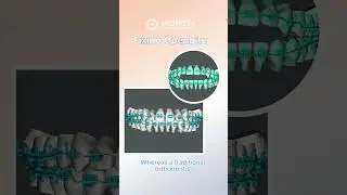 Digital Orthodontics 101  #braces #dentaltreatment #bracesjourney #orthodontist #dentalbraces