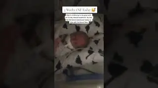 3 Week Old Micro Preemie Baby #3weeksold #micropreemie #preemiebaby #preemies #nicu #nicubaby