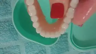 How to Apply a Thermoplastic Denture Adhesive