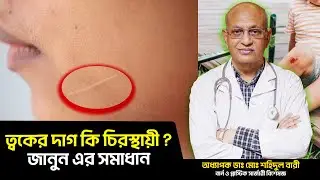 ত্বকের দাগ কি চিরস্থায়ী? জানুন এর সমাধান | Prof. Dr. Md. Shahidul Bari | Plastic & Cosmetic Surgery
