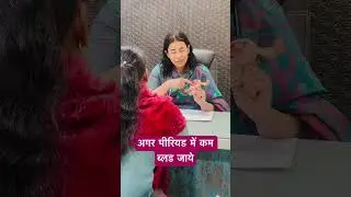 Menstrual flow awareness #doctor #hospital #girl #women #awareness #viral #viralvideo #youtube #tips