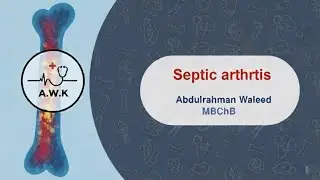 Orthopedic diseases &ldquo; Septic arthritis &ldquo; 