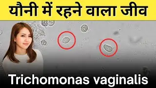 Trichomonas vaginalis under microscope 🔬 | Trichomoniasis | Parasitic infection