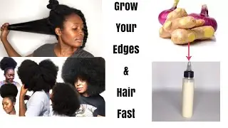 HOW I USE GINGER AND ONIONS FOR UNSTOPPABLE HAIR GROWTH!!!