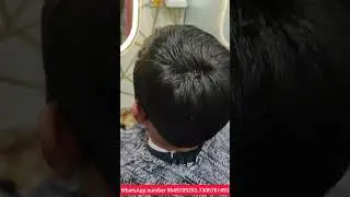 small crown area hair customise #hairpatchsalonranchi #hairpatch #video #hairfixing #hairbonding