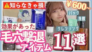 【厳選】本当に効果があった毛穴撃退グッズ１１選！！プチプラでドラックストアでも！【スキンケア】【いちご鼻】【メガ割】