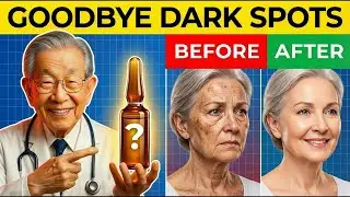 Over 60  1 Vitamin FADES Dark Spots in 12 Weeks  Senior Health Tips