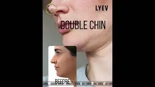 🔥 BTL EXION Body Shaping | First in Bangladesh Only at LYEV Beverly Hills 🔥