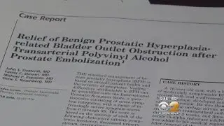 Dr. Max Gomez: Enlarged Prostate