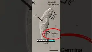 Soldier Parasites Might Be Hiding in Your Fish. #nature #science #parasite #health #fyp