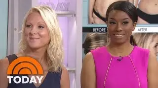 &lsquo;Botched&rsquo; Plastic Surgery: Two Women Share Their Stories | TODAY