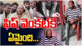 ఫిష్ వెంకట్ కి ఏమైంది...? |Actor Fish Venkat Emotional  | Fish Venkat Health Condition  #sumantvundi
