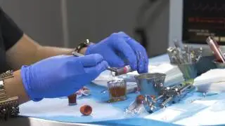 PRF Platelet Rich Fibrin | Heal faster with less inflammation | All-on-4&reg; Dental Implants
