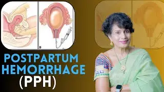 Postpartum Hemorrhage (PPH) - प्रसवोत्तर रक्तस्राव का मुख्य कारण कौन सा है ?