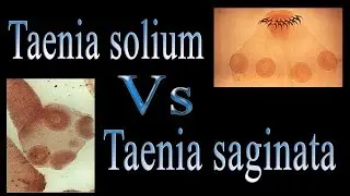 Difference between Taenia solium and Taenia saginata - T.solium Vs T.saginata