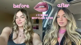 GETTING 1 SYRINGE RESTYLANE KYSEE LIP FILLER  *pain level, aftercare, 2 weeks healing*