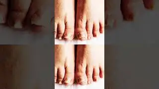 Nail Care ||Odia Health Tips ||Doctor|Dr Manas Puhan ||Skin Specialist ||