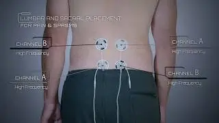 Lumbar and Sacral Placement for Pain and Back Issues Example