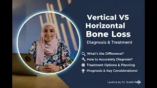 Vertical VS Horizontal Bone Loss &ndash; Diagnosis & Treatment