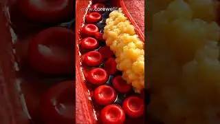 How Cholesterol Affects Blood Circulation .#shorts
