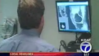 Healthbeat - Aging Joints