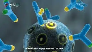 &iquest;C&oacute;mo saber si eres cel&iacute;aco? S&iacute;ntomas y Diagn&oacute;stico | Ambar Lab