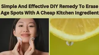 Erase Age Spots with a Cheap Kitchen Ingredient: Simple and Effective Method