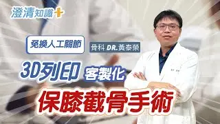 【澄清知識＋】3D列印精準保膝手術 -骨科 黃泰榮醫師
