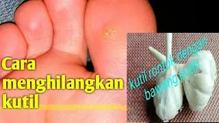 Cara Ampuh Menghilangkan 