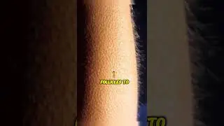 The Mystery of Why Humans Get Goosebumps