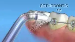 Końc&oacute;wka ortodontyczna OD-100 do irygator&oacute;w WATERPIK
