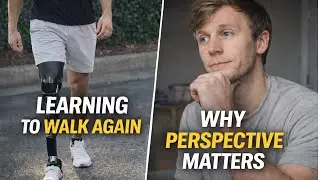 7 Months After Amputation: Recovery Is Physical &mdash; Growth Is Mental