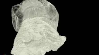 Metridium senile frilledseaanemone