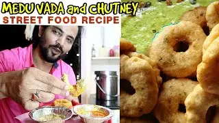 How to make #MeduVada and Coconut Chutney | Medu Vada Street Food Recipe | My Kind of Productions