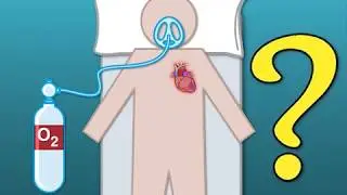 Outcomes with Oxygen in Suspected Myocardial Infarction