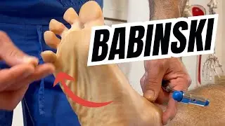 BABINSKI SIGN EXPLAINED: How to ASSESS It (POSITIVE vs NEGATIVE Response)