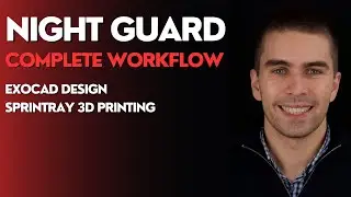 Полный рабочий процесс Night Guard — EXOCAD и SPRINTRAY