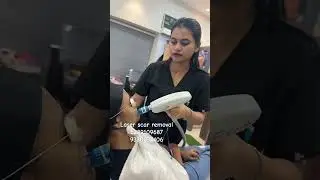 LASER SCAR REMOVAL#dranirbanghosh#anirvana#laserskincare#skincareroutine