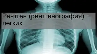 Рентген (рентгенография) легких