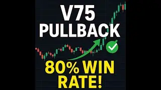 Volatility 75 (1s) | Powerful Pullback Strategy with 80% Win Rate 💥