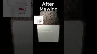 before mewing vs after mewing #shorts #memes #viralvideo #trending