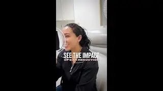 Ear Reduction Impact #shorts
