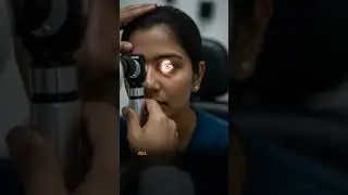 What your eyes say about your health?