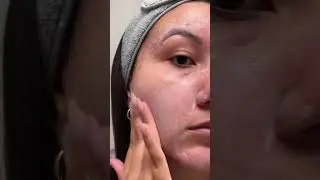 ✨ Elevate your Self-Care Routine with AlumierMD Skincare Products - Sold at Lumilaser Esthetics