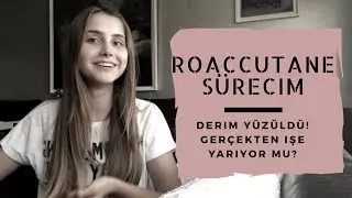 ROACCUTANE SÜRECİM | DERİM YÜZÜLDÜ, Gerçekten İşe Yarıyor Mu?